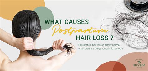 Causes Of Postpartum Hair Loss Bee Choo Origin