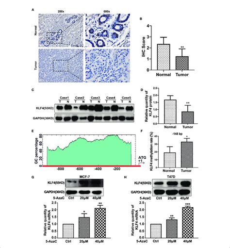 The Expression Of Klf4 Decreased And Its Promoter Hypermethylated In