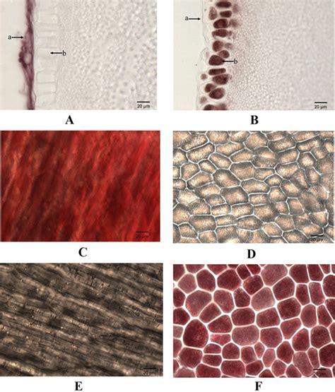 Comparative Transcriptome Analysis Reveals Differentially Expressed