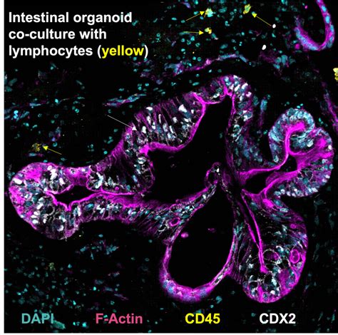 The Role Of The Intestinal Epithelium In Immune Responses To Food