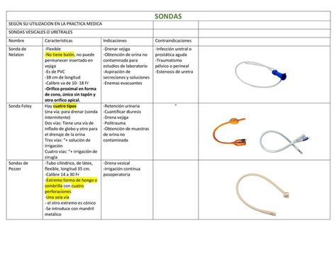 Quais Os Tipos De Sonda - TIPOS DE SONDA | Guadalupe | uDocz