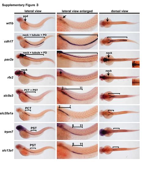 cdx genes  retinoic acid control  positioning