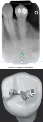 Dental Radiology Chapter 32 33 34 35 Flashcards Quizlet