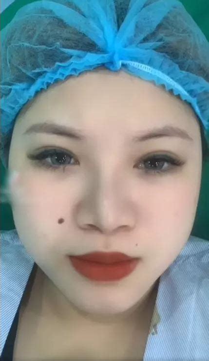 Phẫu thuật nâng mũi hot girl ngực khủng tiết lộ Được cả dàn trai đẹp bên cạnh xoa bóp