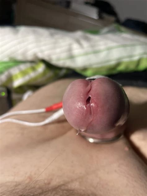 E Stim Nude Pics XHamster