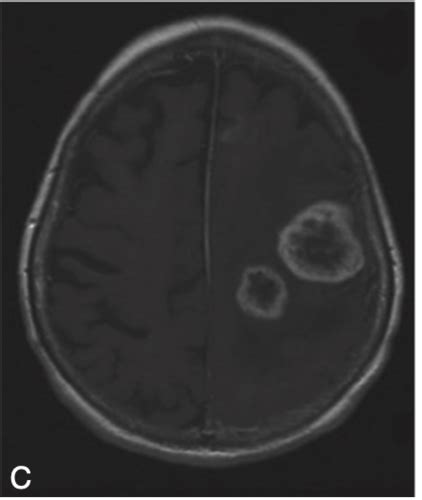 Neurologie Cartes Quizlet