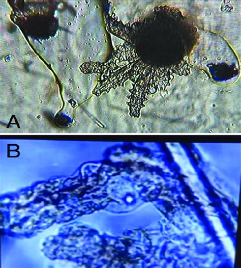 Demodex Mites In The Permethrin Group A Trunk Shrinkage And The Loss