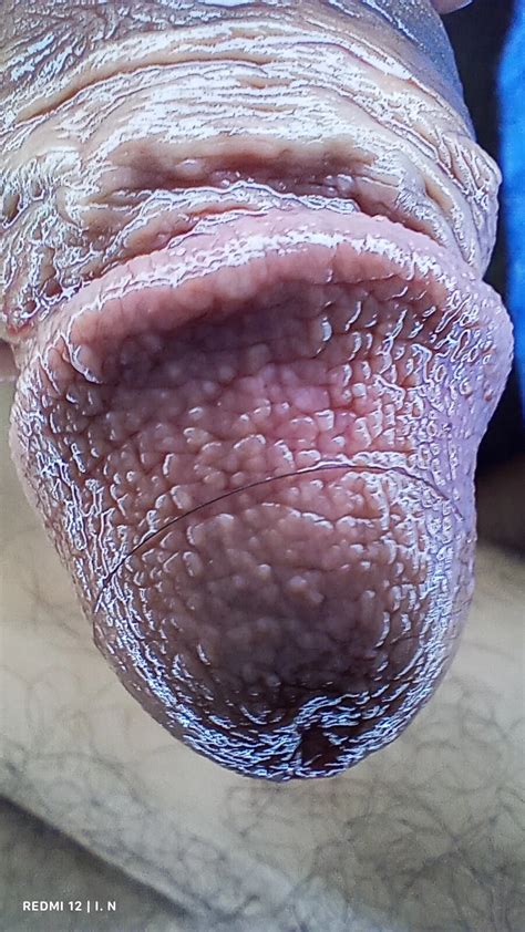 Macro Dick Nude Pics XHamster