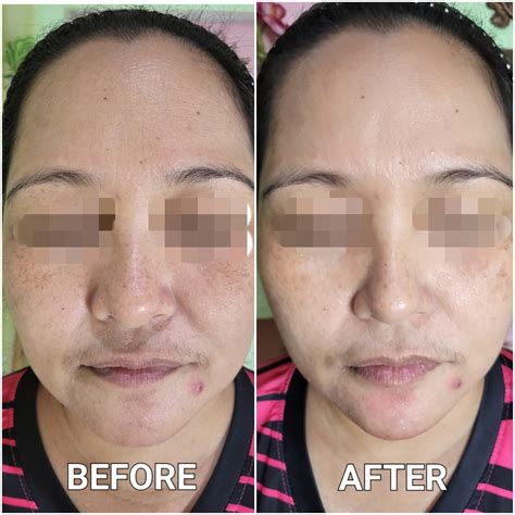 Medical students debate the fairness of the dermatology pa salary