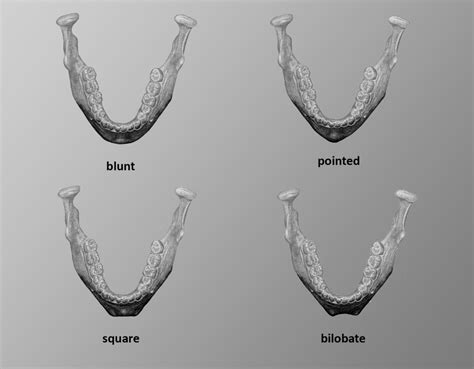 Table 1 From Biological Affinity And Sex Determination Using Morphometric And Morphoscopic