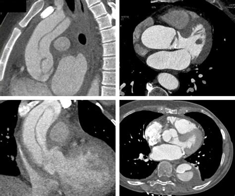 Ct Quick Guides Ct Scanning