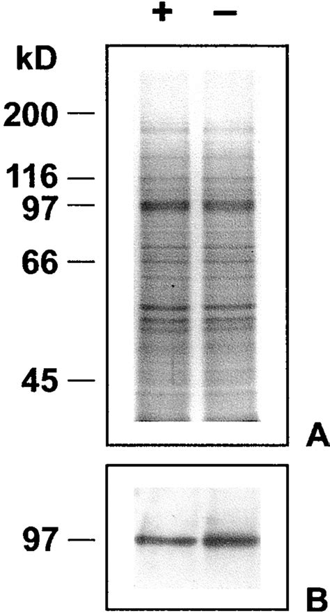 Western Blot Analysis Of Plasma Membrane Vesicle Proteins Vesicles Download Scientific Diagram