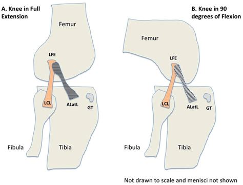 Anatomical Drawing Of The Anterolateral Ligament On The Lateral Aspect Download Scientific