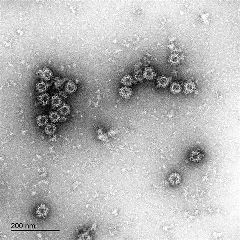 Norovirus GI.1 VP1 virus-like particles - The Native Antigen Company
