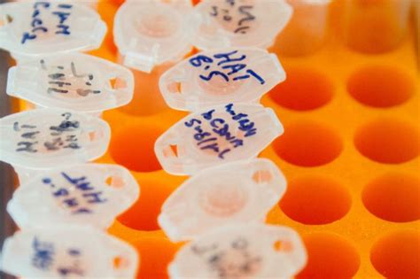 Resolution Therapeutics Scores £635 Million In Series B Round