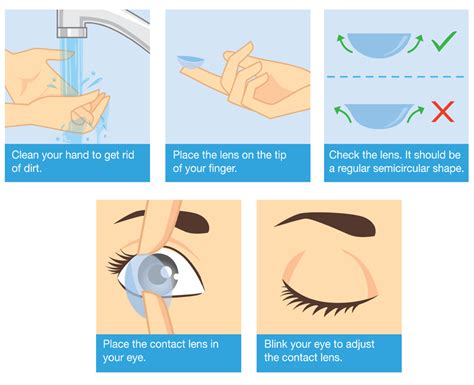 Tips For Removing Soft Contact Lenses At Jennifer Mader Blog