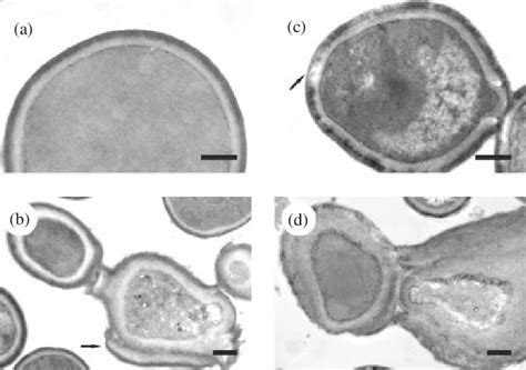 Transmission Electron Microscopy Photographs Of Candida Albicans