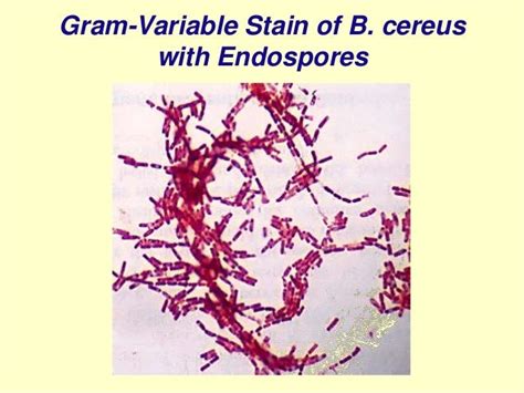 1 Spore Forming Gram Positive Bacilli 2014