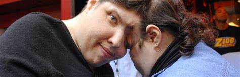 Im A Conjoined Twin But Still Have Sex My Brother Faces Away On Dates Hot Lifestyle News