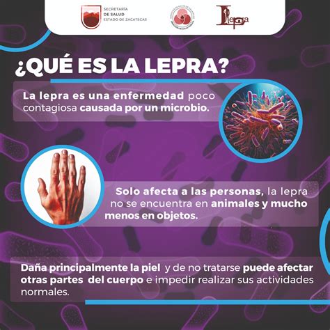 Hoy se conmemora el Día Mundial de Lucha contra la Lepra | Testigo Ocular