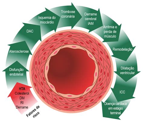 Fisiopatologia Da Hipertensão Arterial Sistêmica ROAREDU