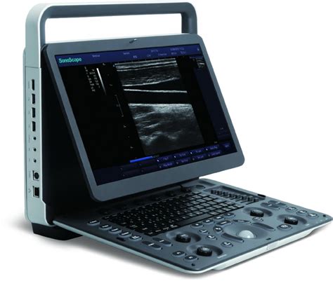 Sonoscape E Ultrasound Systems Veterinary Equipment Mano Medical