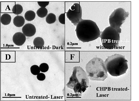 Figure S Tem Analysis Of S Aureus A C Untreated Cells A