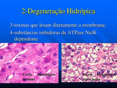 O Que É Degeneração - O Que é Degeneração - FDPLEARN