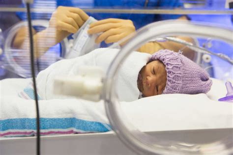 Sonhar Com Bebe Prematuro - Fotos de bebés prematuros | Estilo de Vida Madres | Univision