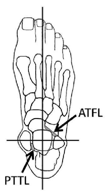 Superior View Of The Talus In A Neutral Position Within The Transverse
