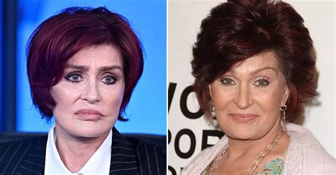 Sharon Osbourne Quits Plastic Surgery For Good After Horrendous