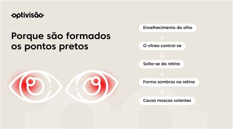 Pontos Pretos Na Visão E Tontura - Sentir pontos pretos na visão: veja se é normal | Optivisão