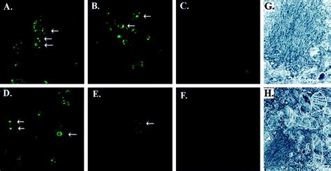 The A53T α-Synuclein Mutation Increases Iron-Dependent Aggregation and ...