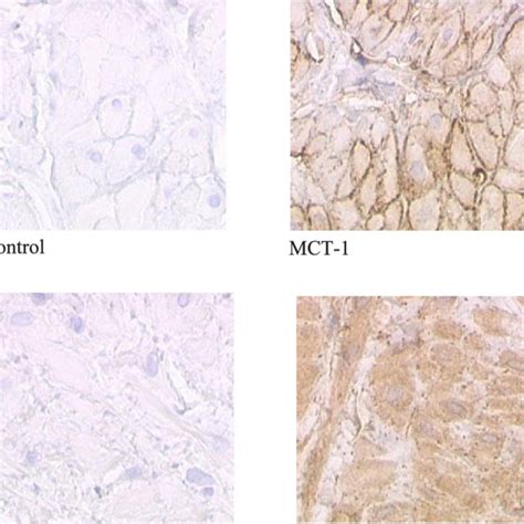 Monocarboxylate Transporter 1 Mct 1 And Monocarboxylate Transporter 4 Download Scientific