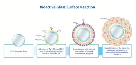 Ceramic Biomaterials By Jon Velez Openwetware