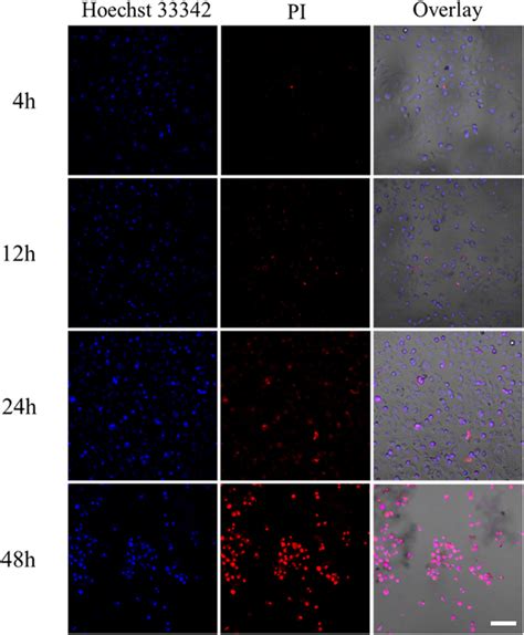 Clsm Images Of A Cells Treated With Ucnps Ptx Silane G Ml