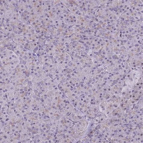 Rabbit Polyclonal Anti Add2 Antibody Buy For Research Highly