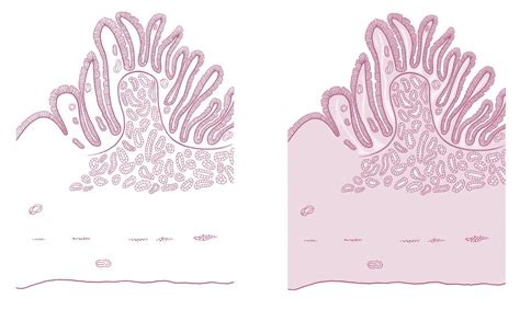 Small Intestine Duodenum Longitudinal Section