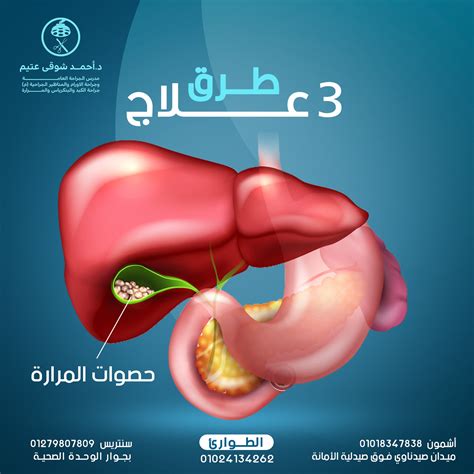 social media posts on Behance