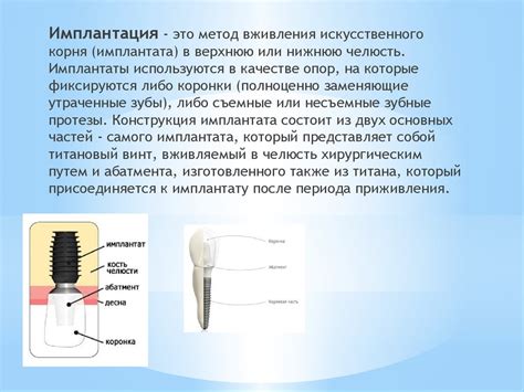 Основы имплантации в стоматологии - презентация онлайн