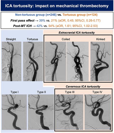 Netter S Correlative Imaging Cardiothoracic Anato 4