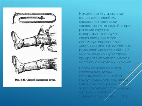 Временная остановка кровотечения наложением давящей повязки, жгута ...