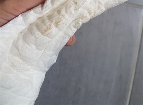 Was Bedeutet Brauner Ausfluss - inspirex