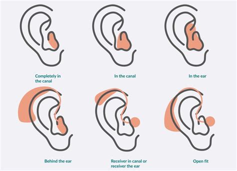 Quels Sont Les Diff Rents Types Et Styles D Aides Auditives