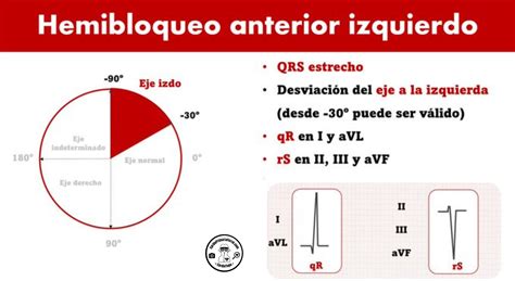 CardioTruco Hemibloqueos Cardioprimaria Ferrol