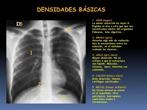 Imagenología Del Tórax Clase
