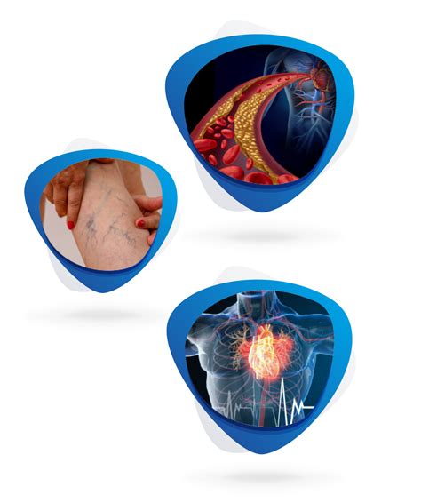 Cardiovascular Disease Models Pharmalegacy Preclinical Pharmacology Cro