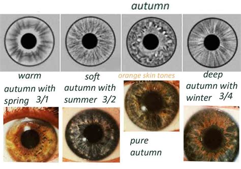 What is iris color chart? | iriscope | iridology camera | iriscope ...