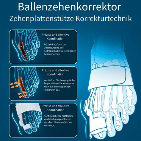 Adjustable Hallux Valgus Correction Rail for Big Toe Straightening