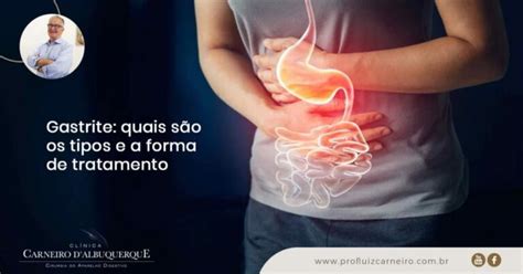 O Que Gastrite Cronica - Gastrite: Quais São Os Tipos E A Forma De Tratamento - Prof Dr. Luiz ...